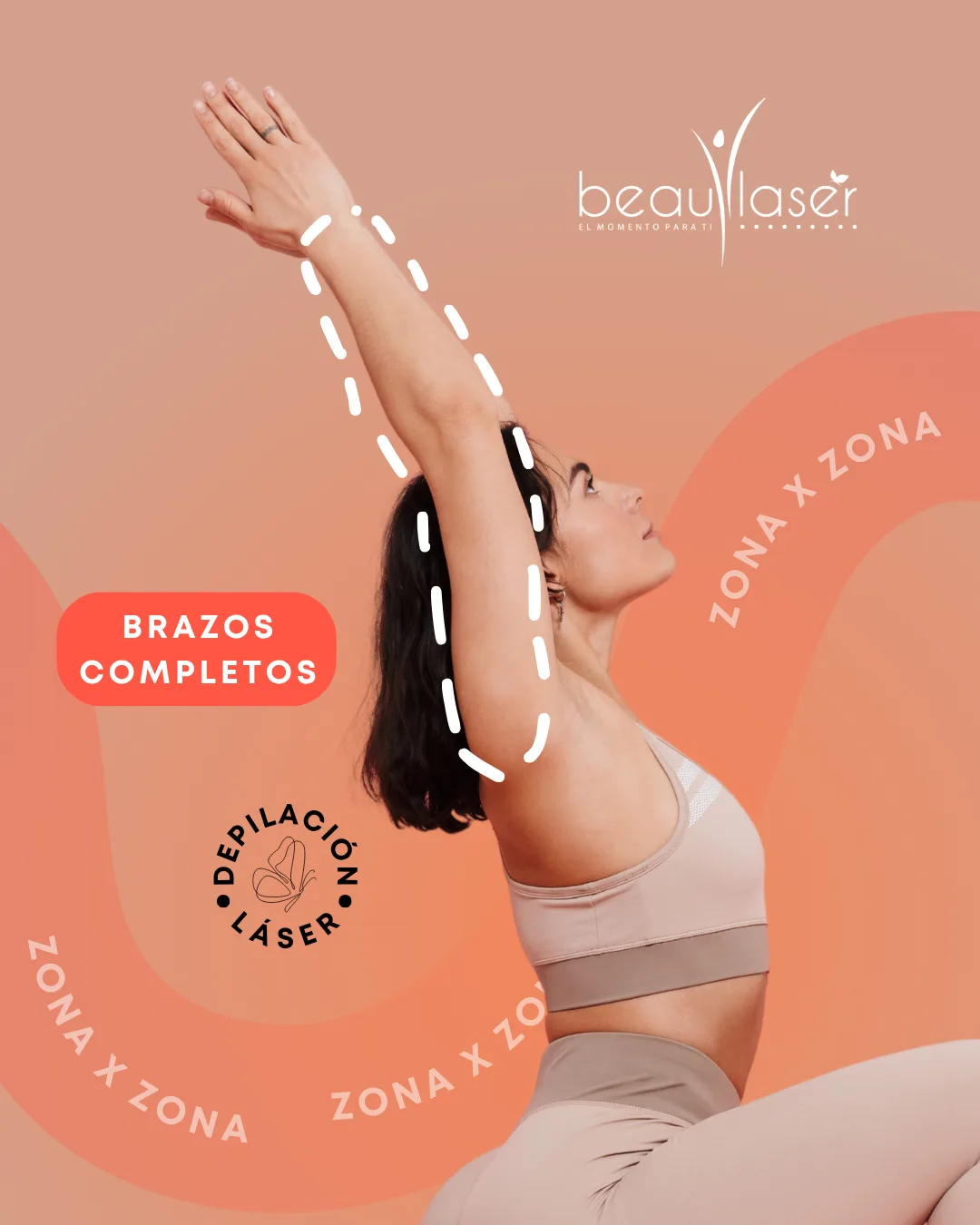Depilación láser — brazos completos