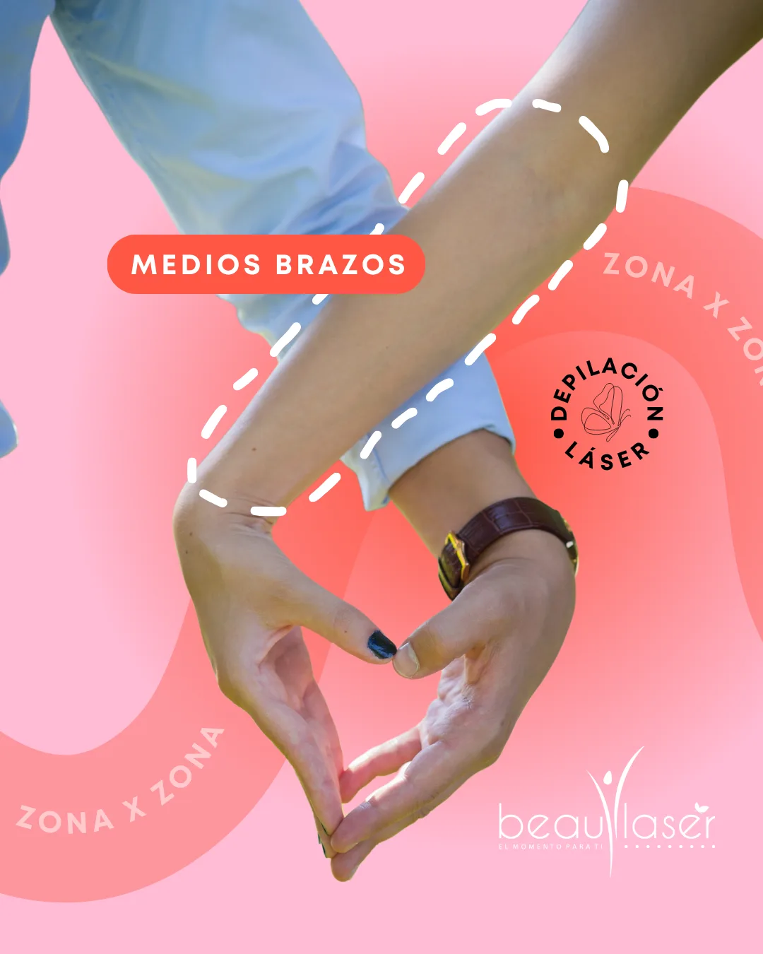 Depilación láser — medios brazos