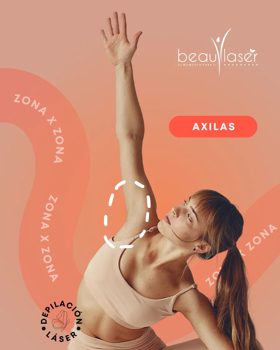 Depilación láser — axilas